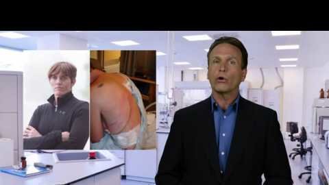 American Medical Association discredits Dry Needling by non professionals!