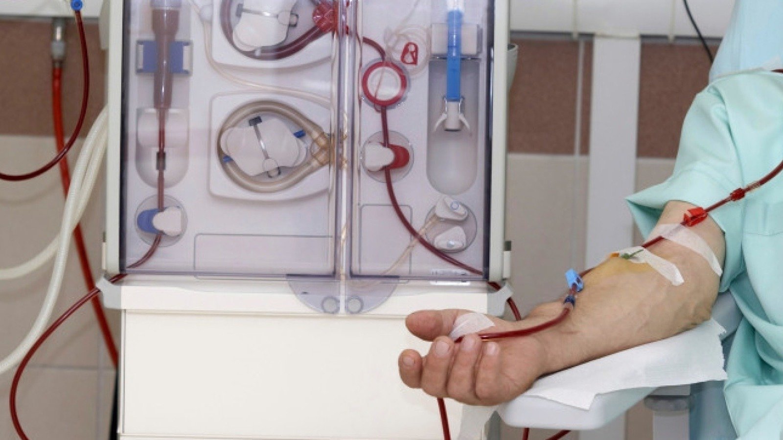 Hemodialysis thesis image