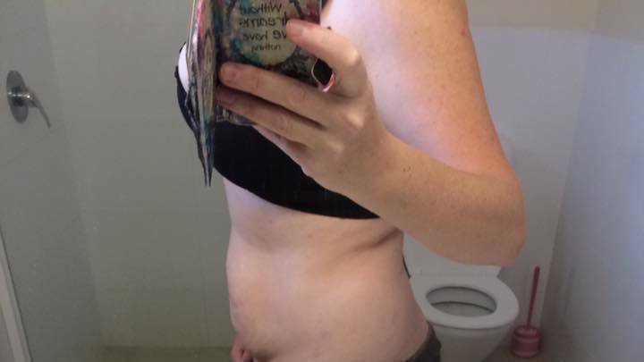 6 MONTHS POST MIRENA REMOVAL