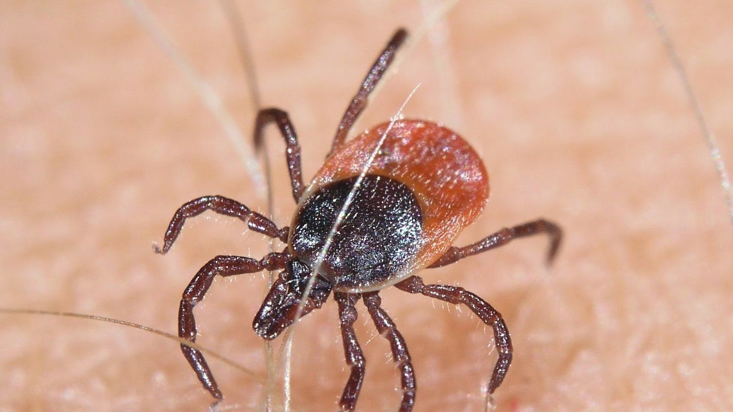 Petition · Demand that Health Canada get proper testing for Lyme ...