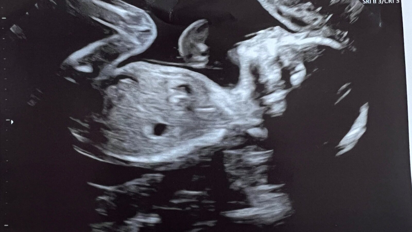 Petition · Extend Visiting Hours for Partners/Dads in Hospitals After