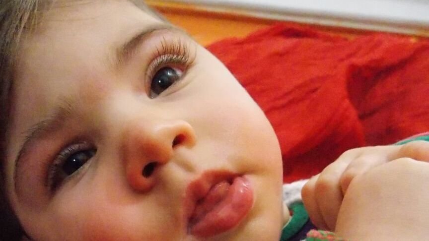 toxoplasmosis tiene cura