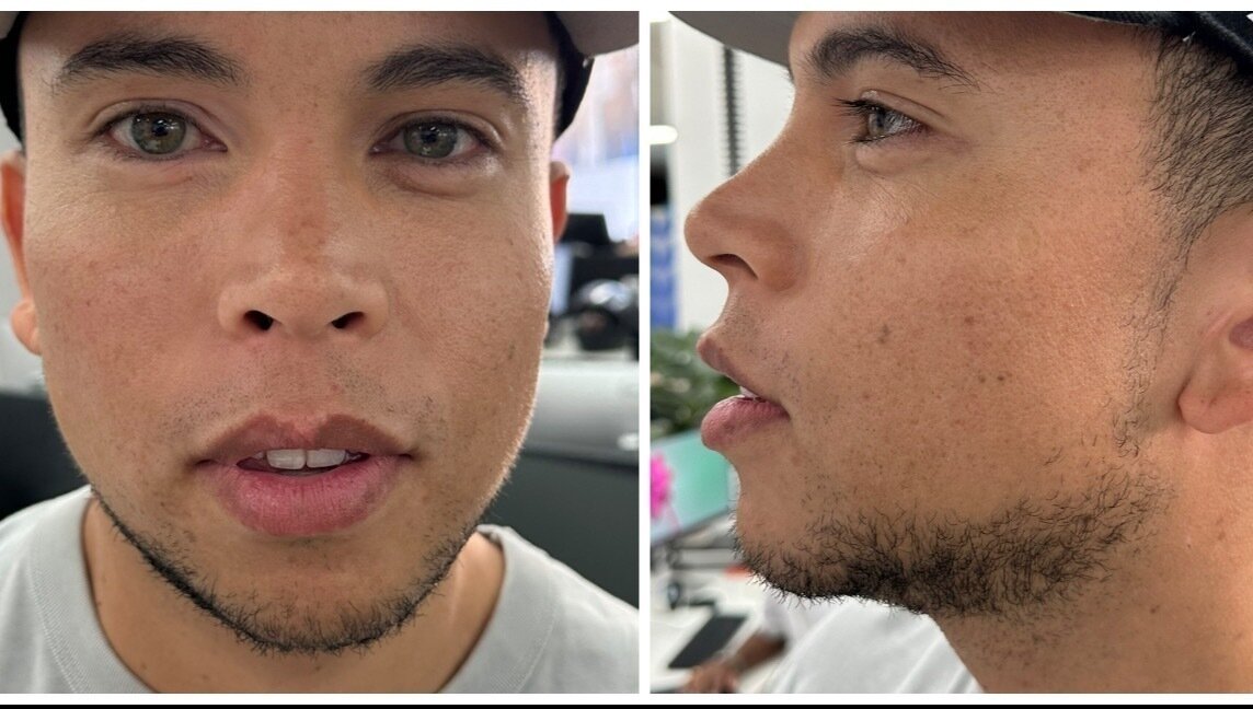 Petition · Ban the Chin Strap Facial Hair Style A Call for Kian to