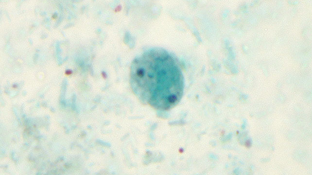 Dientamoeba fragilis жизненный цикл. Dientamoeba fragilis жизненный цикл. Dientamoeba fragilis. Dientamoeba fragilis жизненный цикл. Диэнтамеба.