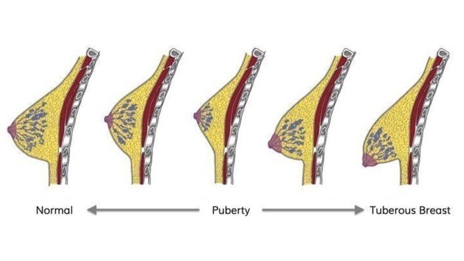 petition-petition-to-change-the-classification-of-congenital-breast