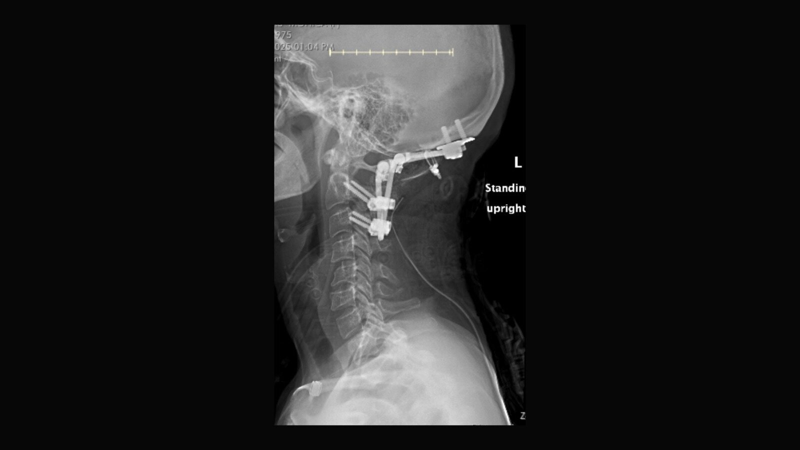Petition · My Neck Collapsed. The System Let It Happen. - United States ...