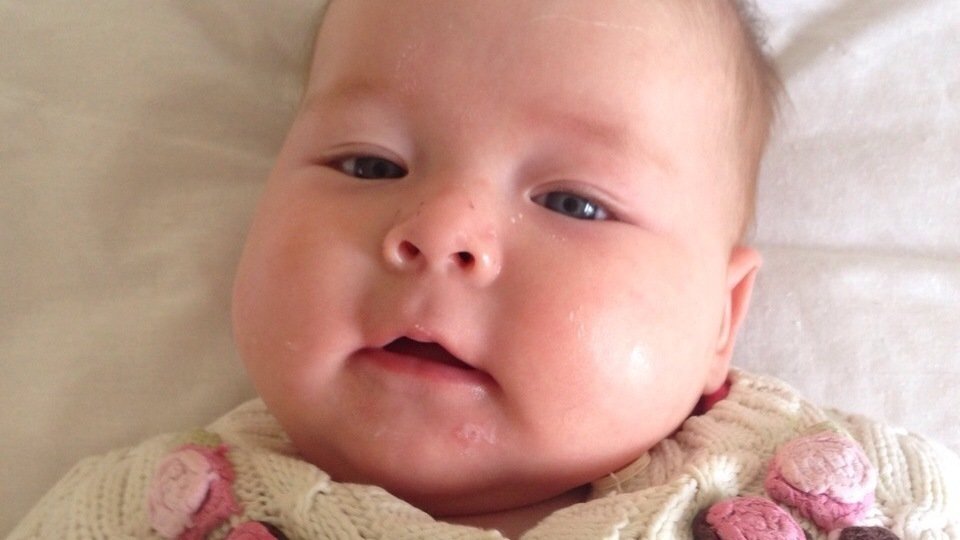 Петиция · 4-месячной Верочке срочно требуется помощь.Диагноз ...