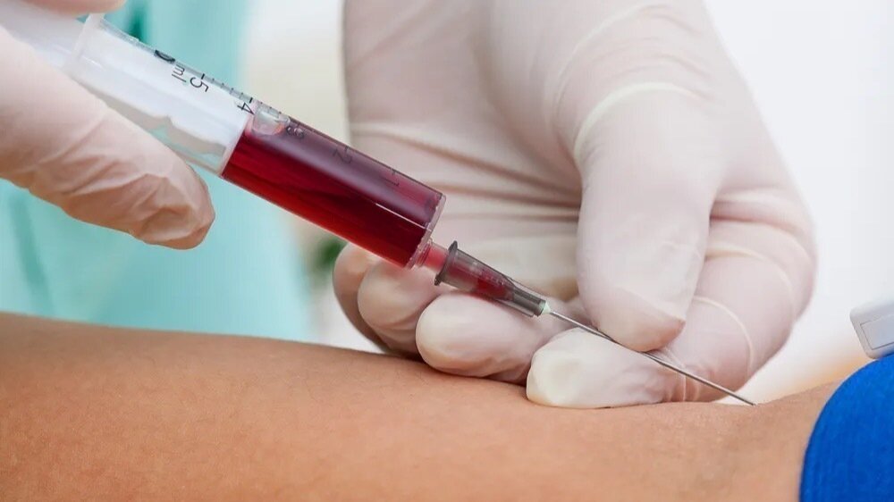 Amazing Can Police Take Blood Samples From Hospital Photo for Desktop Amazing Can Police Take Blood Samples From Hospital Photo for Desktop