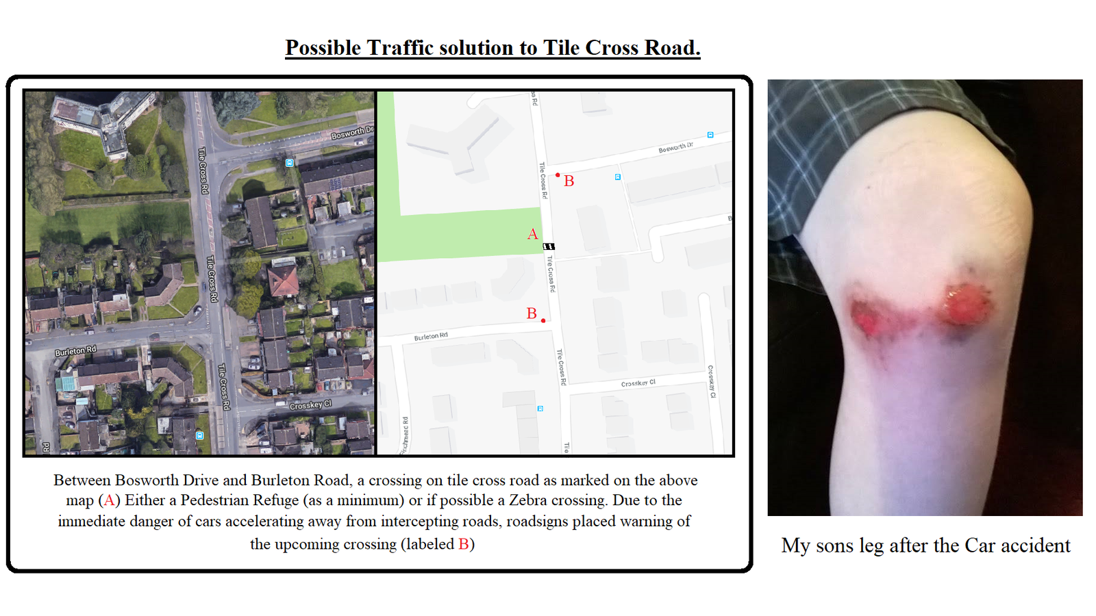 Petition · Support Road improvements to Tile Cross Road, Birmingham B33