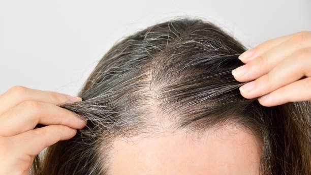 Petition · Get To Know The Best Hair Growth Product · Change.org