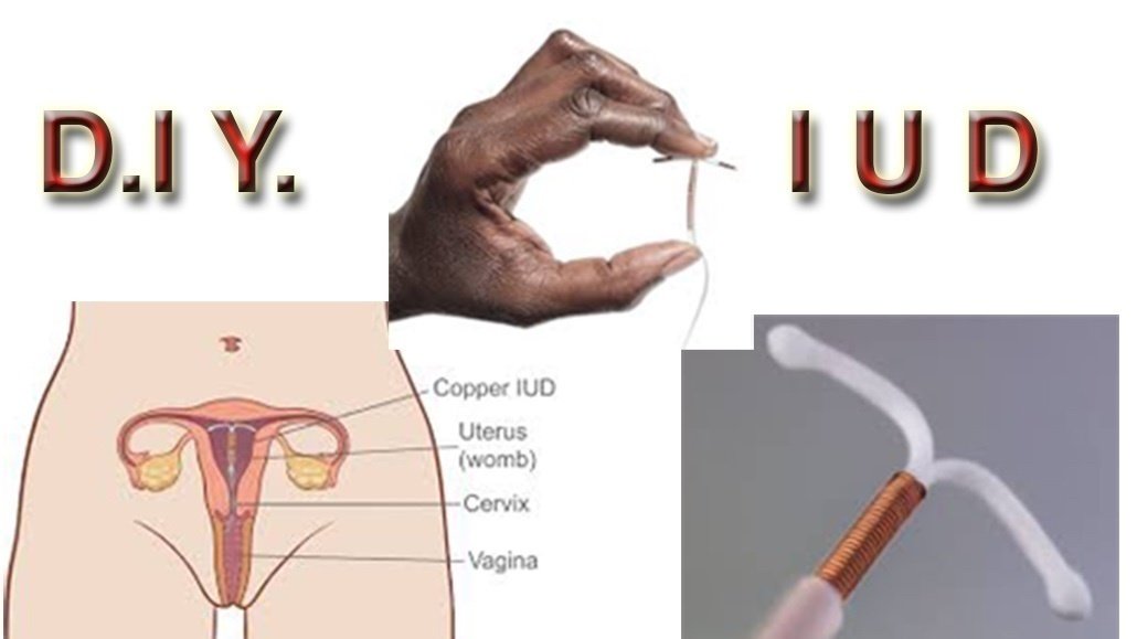 Petition Release The Diy Iud Change Org