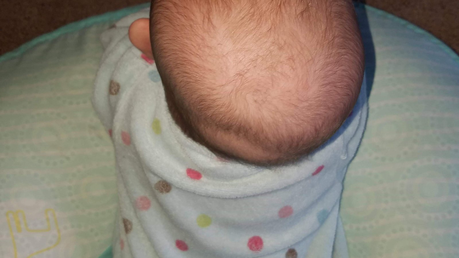 Petition · TriCare Cover cranial helmets for babies who need them
