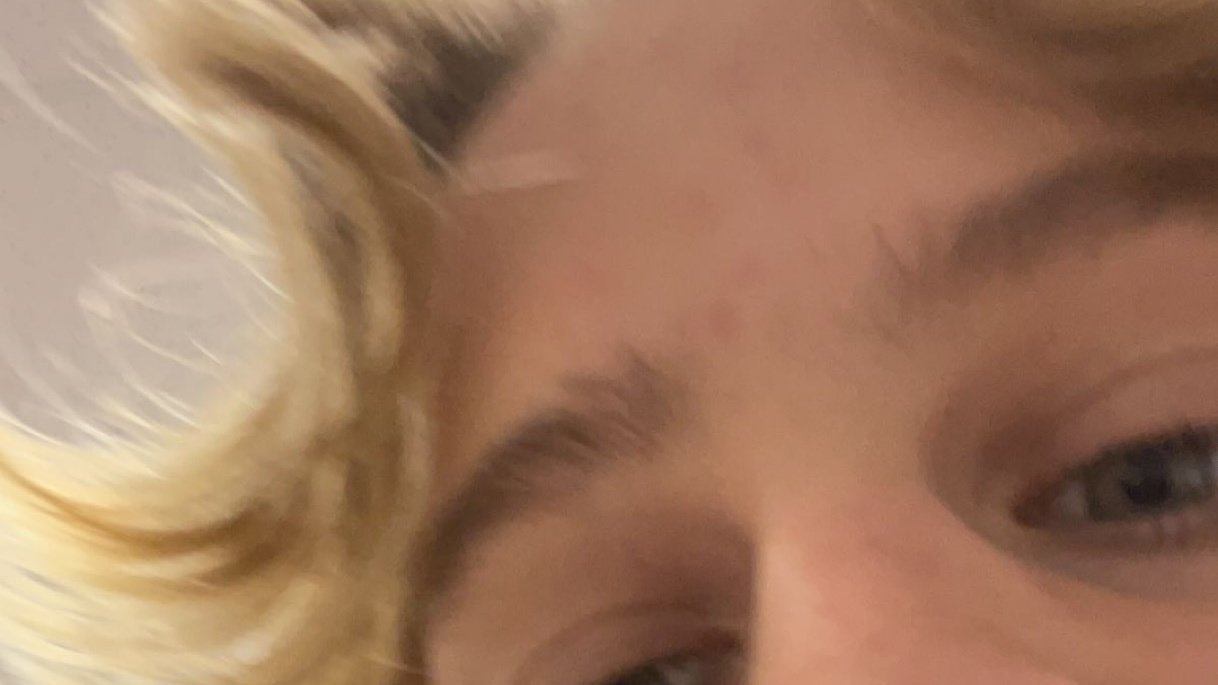 Petition Make Hayden Get Rid Of His Middle Part Change