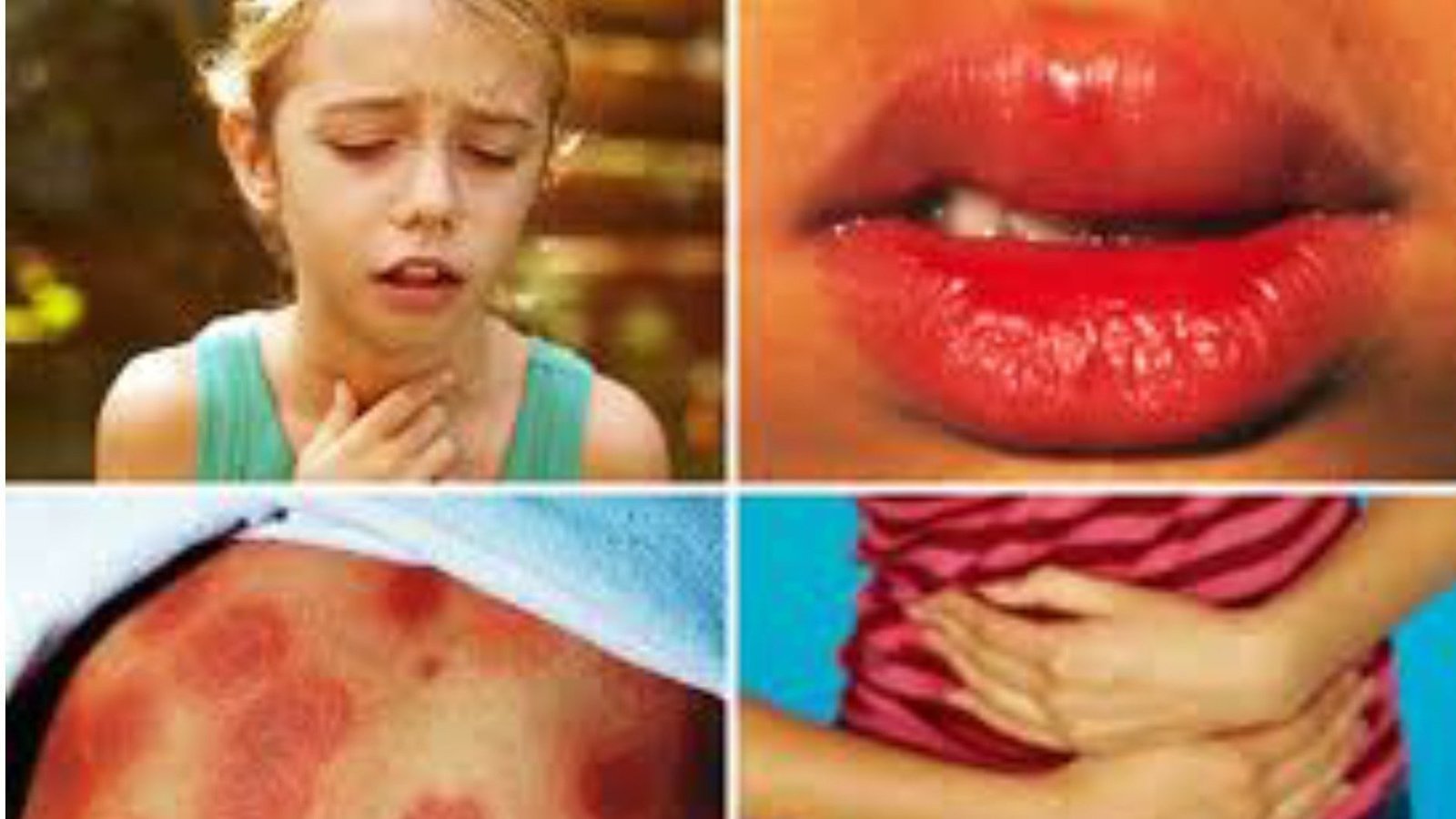 Petition · Starbucks Allergies Matter! United States ·