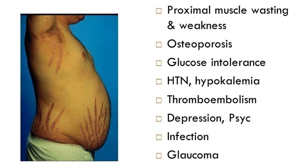 Petition · Cushing disease is a longlife threatening rare disease it