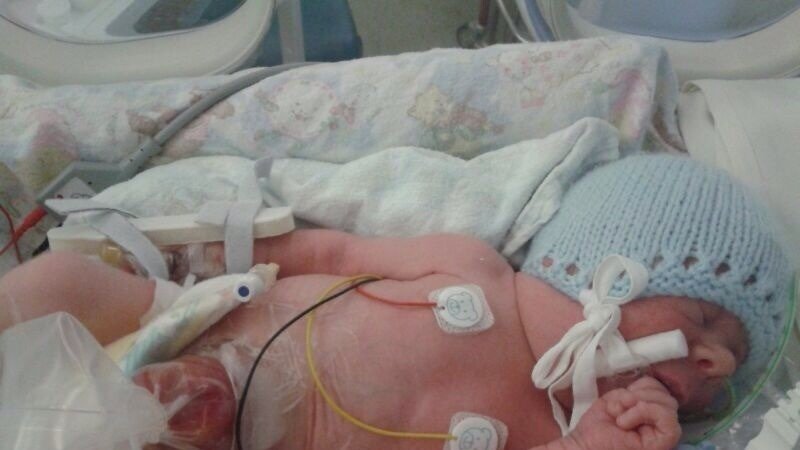 petition raise awareness of the birth defect organs in the body
