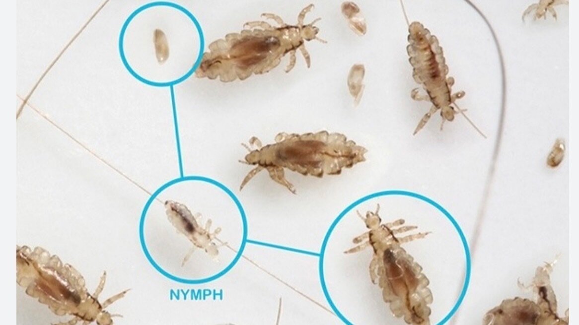 Petition · Head Lice Protocol Prather, United States ·