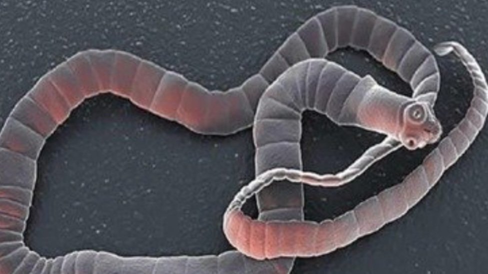 Petition · Toxoplasmosis from Cats, Cat Owners Clean up/use a litter