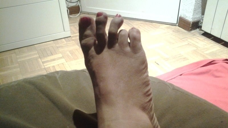 me duelen los dedos de los pies al caminar me duelen los dedos de los pies al caminar
